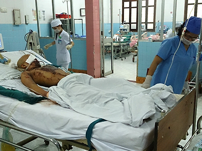 Three days after the accident, Hoan is still in a coma and under special monitoring at Quang Tri Hospital’s Emergency Room where he’s on a mechanical ventilator. Photo: Hoang Tao, VnExpress.